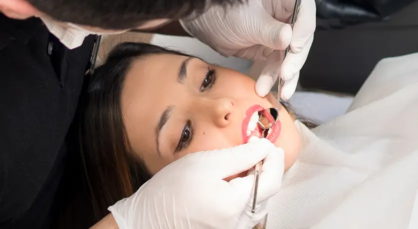 Dental Fillings